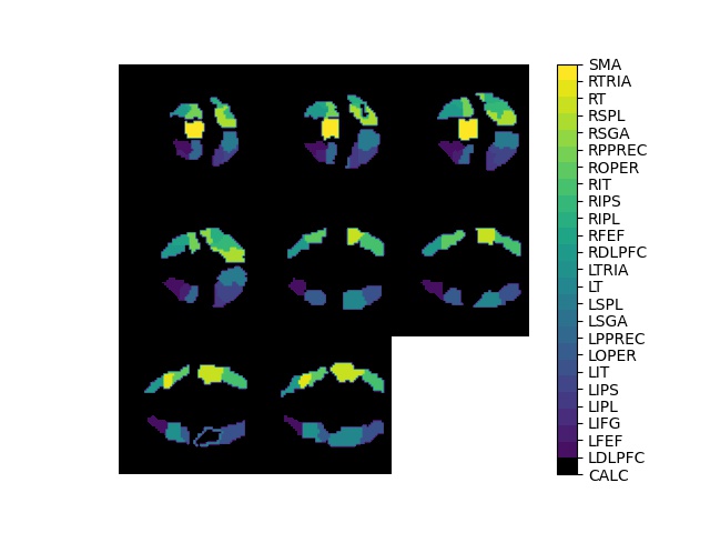 brain1