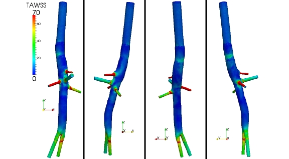 Aorte