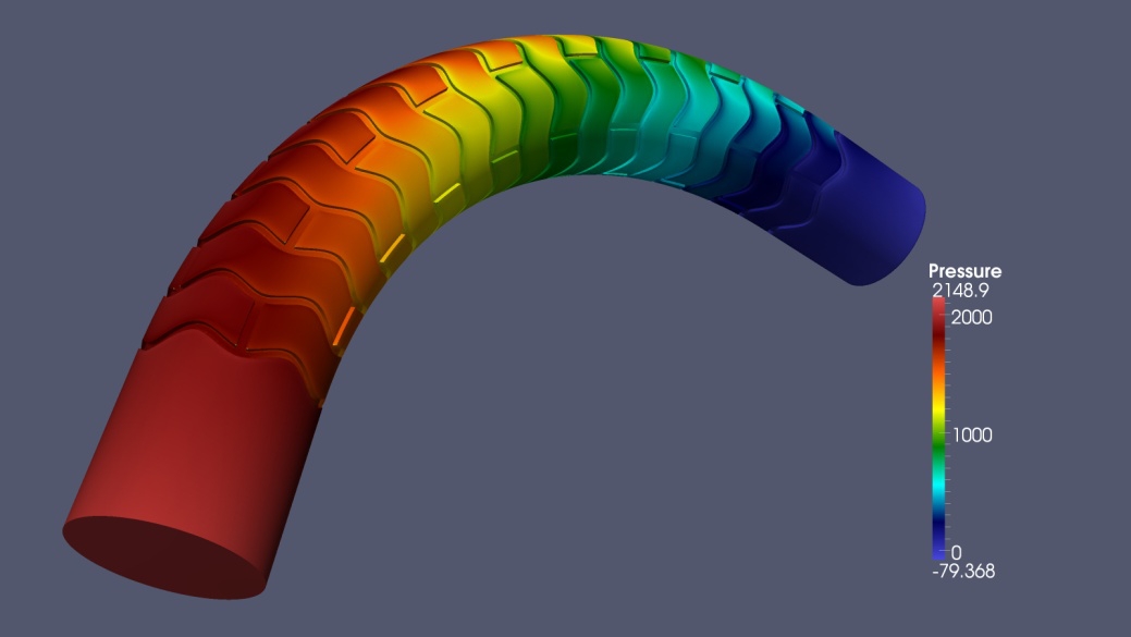 Stent1