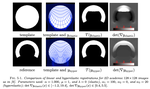 A Hyperelastic Regularization Energy for Image Registration